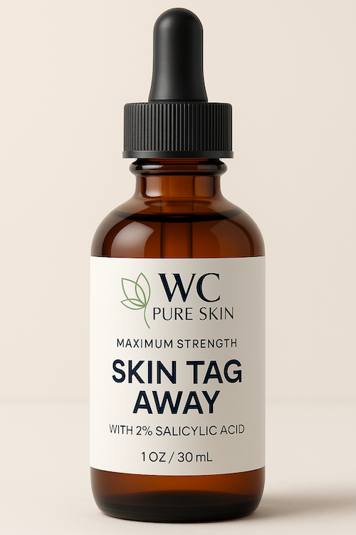 Skin Tag Away